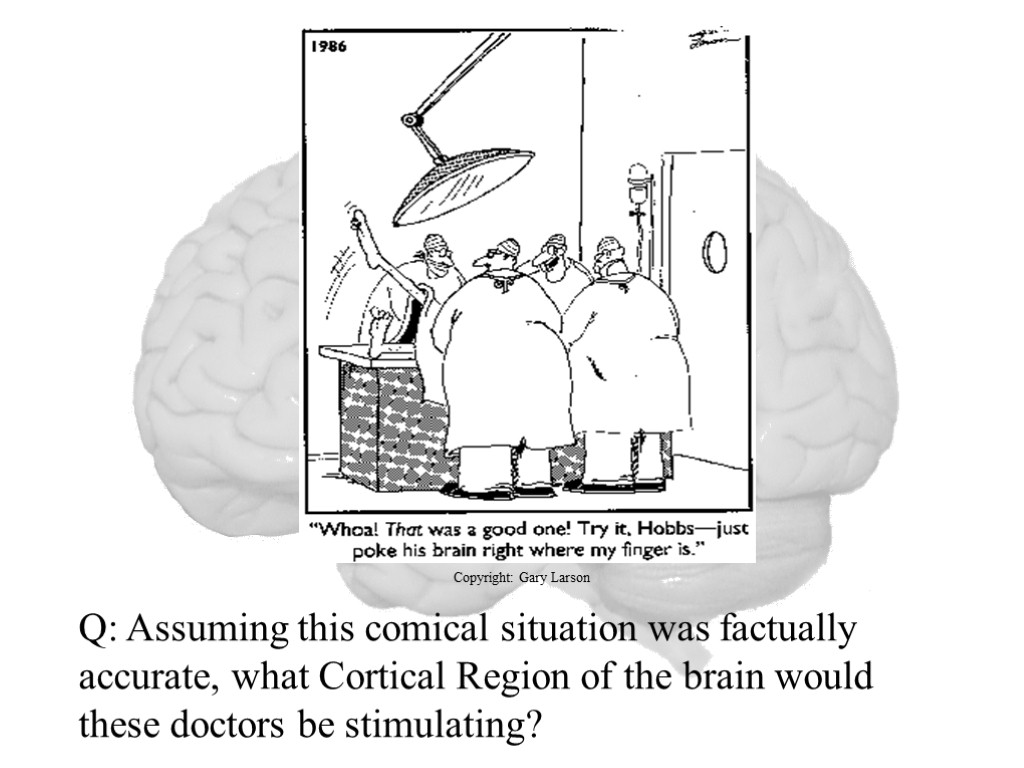Q: Assuming this comical situation was factually accurate, what Cortical Region of the brain